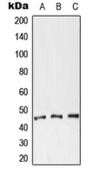 Anti-Coxsackie Adenovirus Receptor antibody used in Western Blot (WB). GTX56276