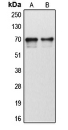 Anti-CYP1B1 antibody used in Western Blot (WB). GTX56279