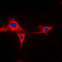 Anti-CYP2A13 antibody used in Immunocytochemistry/ Immunofluorescence (ICC/IF). GTX56282