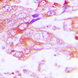 Anti-CYP2A13 antibody used in IHC (Paraffin sections) (IHC-P). GTX56282