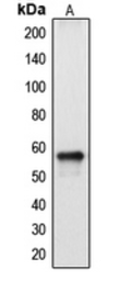 Anti-CYP2A13 antibody used in Western Blot (WB). GTX56282