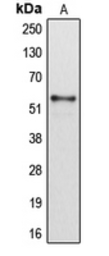 Anti-CYP2B6 antibody used in Western Blot (WB). GTX56284