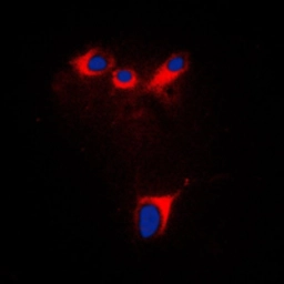 Anti-CYP2E1 antibody used in Immunocytochemistry/ Immunofluorescence (ICC/IF). GTX56290