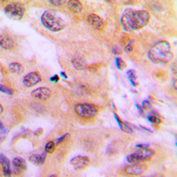 Anti-CYP2J2 antibody used in IHC (Paraffin sections) (IHC-P). GTX56291