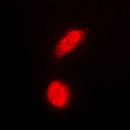 Anti-Daxx antibody used in Immunocytochemistry/ Immunofluorescence (ICC/IF). GTX56298