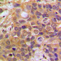Anti-Daxx antibody used in IHC (Paraffin sections) (IHC-P). GTX56298