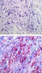 Anti-TLR4 antibody [76B357.1] used in IHC (Paraffin sections) (IHC-P). GTX57153