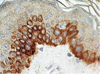 Anti-TLR4 antibody [76B357.1] used in IHC (Paraffin sections) (IHC-P). GTX57153