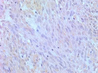 Anti-TLR4 antibody [76B357.1] used in IHC (Paraffin sections) (IHC-P). GTX57153