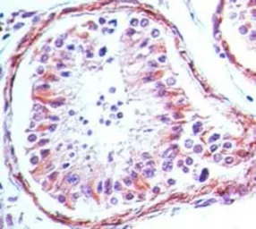 Anti-TLR4 antibody [76B357.1] used in IHC (Paraffin sections) (IHC-P). GTX57153