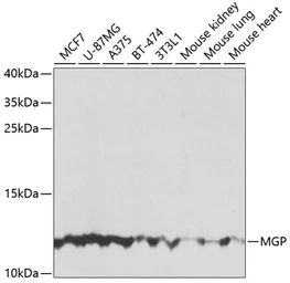 Anti-MGP antibody used in Western Blot (WB). GTX57155