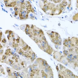 Anti-MGP antibody used in IHC (Paraffin sections) (IHC-P). GTX57155
