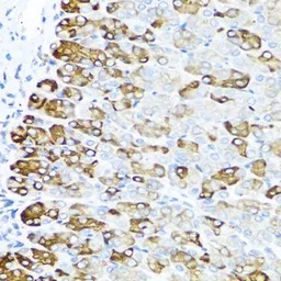 Anti-MGP antibody used in IHC (Paraffin sections) (IHC-P). GTX57155