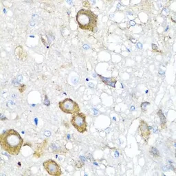 Anti-MGP antibody used in IHC (Paraffin sections) (IHC-P). GTX57155