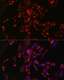 Anti-HB EGF antibody used in Immunocytochemistry/ Immunofluorescence (ICC/IF). GTX57159
