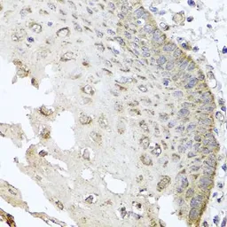 Anti-IRS2 antibody used in IHC (Paraffin sections) (IHC-P). GTX57160