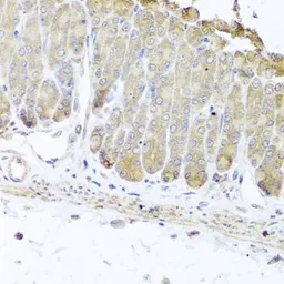 Anti-IRS2 antibody used in IHC (Paraffin sections) (IHC-P). GTX57160