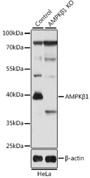 Anti-AMPK beta 1 antibody used in Western Blot (WB). GTX57162