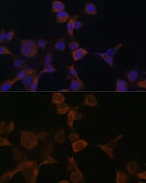 Anti-AMPK beta 1 antibody used in Immunocytochemistry/ Immunofluorescence (ICC/IF). GTX57162