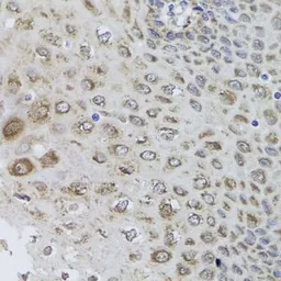 Anti-AMPK beta 1 antibody used in IHC (Paraffin sections) (IHC-P). GTX57162