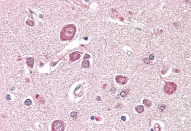 Anti-SDCCAG8 antibody used in IHC (Paraffin sections) (IHC-P). GTX57169