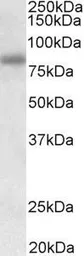 Anti-SDCCAG8 antibody used in Western Blot (WB). GTX57169