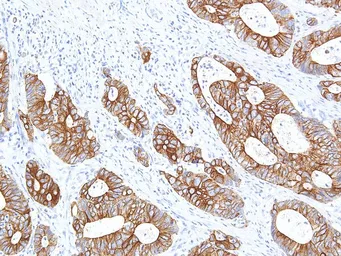 Anti-Cytokeratin 14 antibody [IHC555] used in IHC (Paraffin sections) (IHC-P). GTX57171