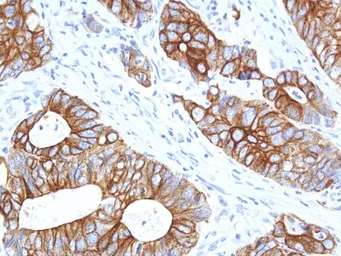 Anti-Cytokeratin 14 antibody [IHC555] used in IHC (Paraffin sections) (IHC-P). GTX57171