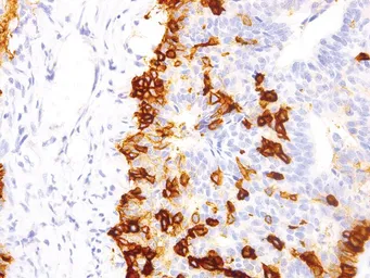 Anti-p75 NGF Receptor / CD271 antibody [IHC637] used in IHC (Paraffin sections) (IHC-P). GTX57176