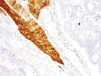 Anti-Arginase 1 antibody [IHC400] used in IHC (Paraffin sections) (IHC-P). GTX57178
