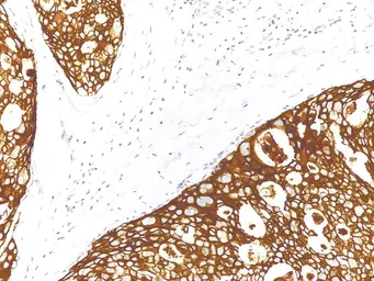 Anti-Her2 / ErbB2 antibody [IHC002] used in IHC (Paraffin sections) (IHC-P). GTX57184