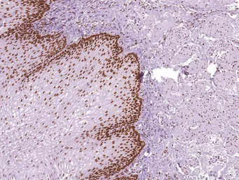 Anti-MSH6 antibody [IHC006] used in IHC (Paraffin sections) (IHC-P). GTX57188