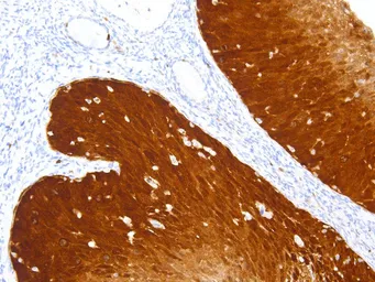 Anti-CDKN2A / p16INK4a antibody [IHC016] used in IHC (Paraffin sections) (IHC-P). GTX57189