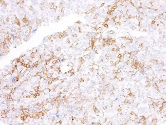 Anti-PD-L1 antibody [IHC411] used in IHC (Paraffin sections) (IHC-P). GTX57193