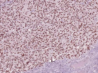 Anti-SOX10 antibody [IHC010] used in IHC (Paraffin sections) (IHC-P). GTX57197
