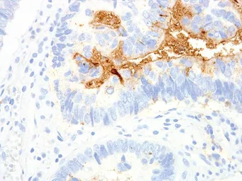 Anti-TAG72 antibody [IHC072] used in IHC (Paraffin sections) (IHC-P). GTX57198