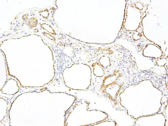 Anti-Tau antibody [IHC696] used in IHC (Paraffin sections) (IHC-P). GTX57199