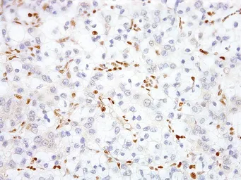 Anti-TFE3 antibody [IHC672] used in IHC (Paraffin sections) (IHC-P). GTX57200
