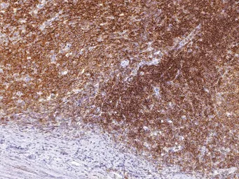 Anti-CD45 antibody [IHC045] used in IHC (Paraffin sections) (IHC-P). GTX57203