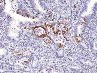 Anti-Mucin 5AC antibody [IHC625] used in IHC (Paraffin sections) (IHC-P). GTX57205