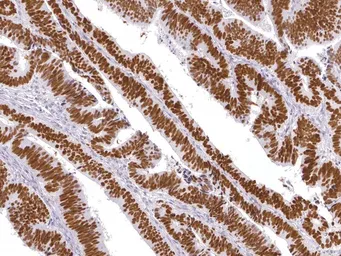 Anti-p53 antibody [IHC053] used in IHC (Paraffin sections) (IHC-P). GTX57208