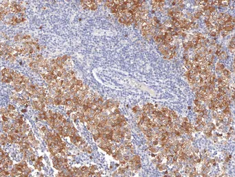 Anti-Podoplanin antibody [IHC650] used in IHC (Paraffin sections) (IHC-P). GTX57209