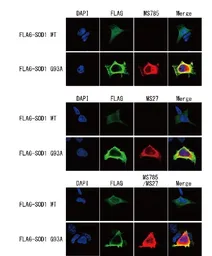 Anti-SOD1 (mutant) antibody [MS27] used in Immunocytochemistry/ Immunofluorescence (ICC/IF). GTX57212