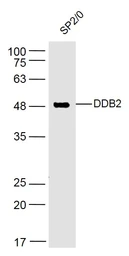 Anti-DDB2 antibody used in Western Blot (WB). GTX57218
