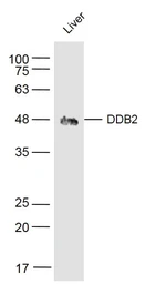 Anti-DDB2 antibody used in Western Blot (WB). GTX57218