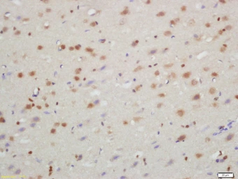 Anti-TXNIP antibody used in IHC (Paraffin sections) (IHC-P). GTX57221