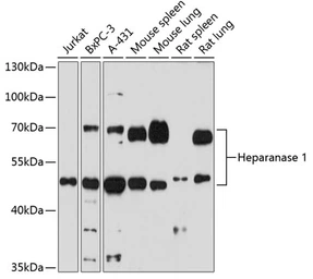 Anti-Heparanase 1 antibody used in Western Blot (WB). GTX57224