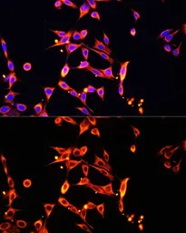 Anti-Heparanase 1 antibody used in Immunocytochemistry/ Immunofluorescence (ICC/IF). GTX57224