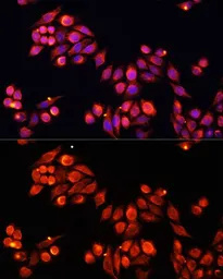 Anti-Heparanase 1 antibody used in Immunocytochemistry/ Immunofluorescence (ICC/IF). GTX57224
