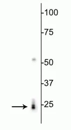 Anti-RBPMS antibody used in Western Blot (WB). GTX57225